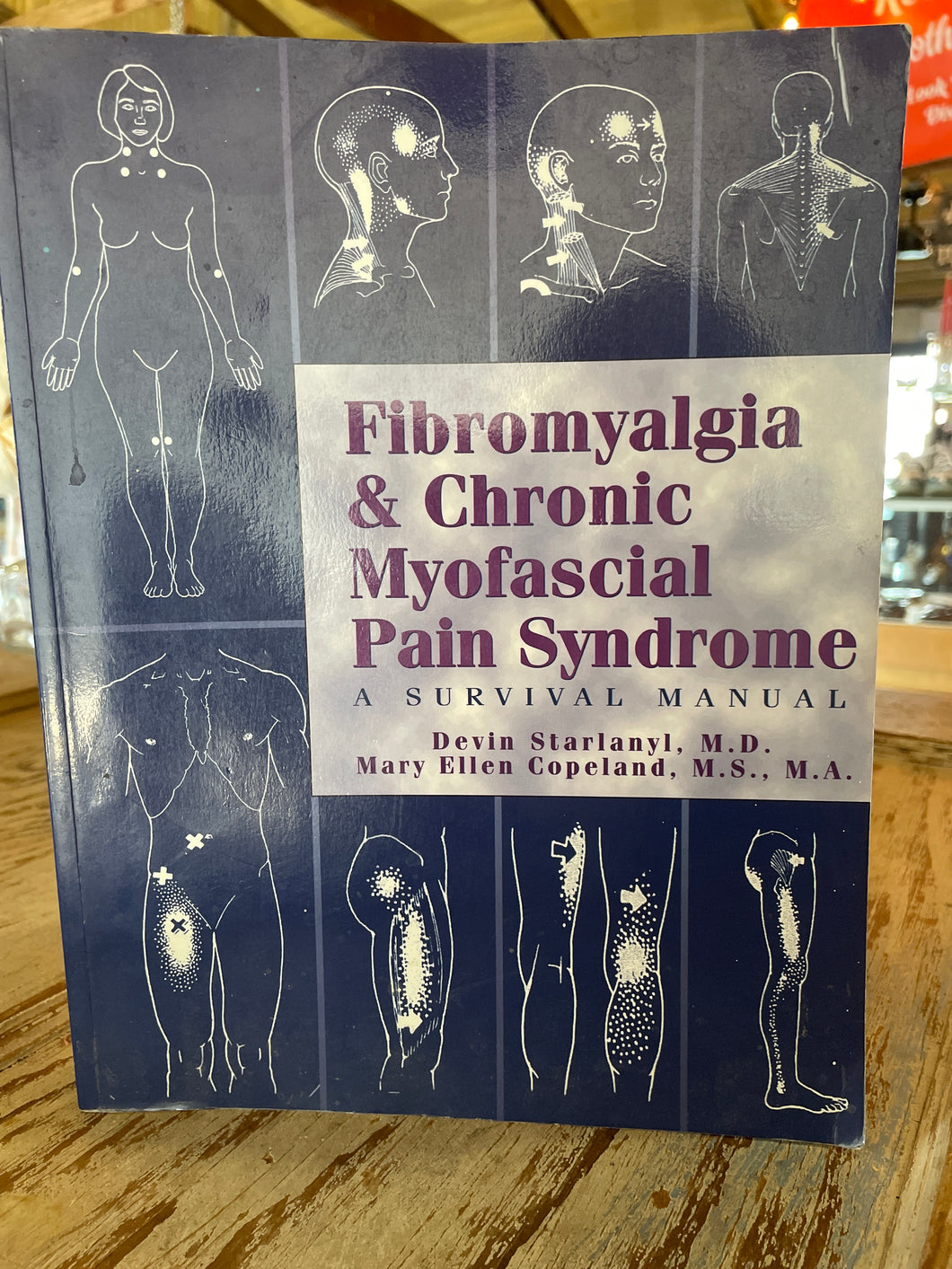 Fibromyalgia & Chronic Myofascial Pain